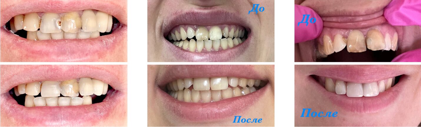 Beauty in Aesthetics: Комплексный подход к стоматологии и косметологии в Нижнем Новгороде